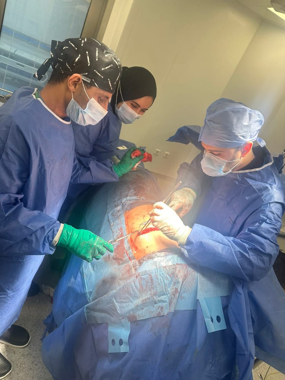 جانب من العملية