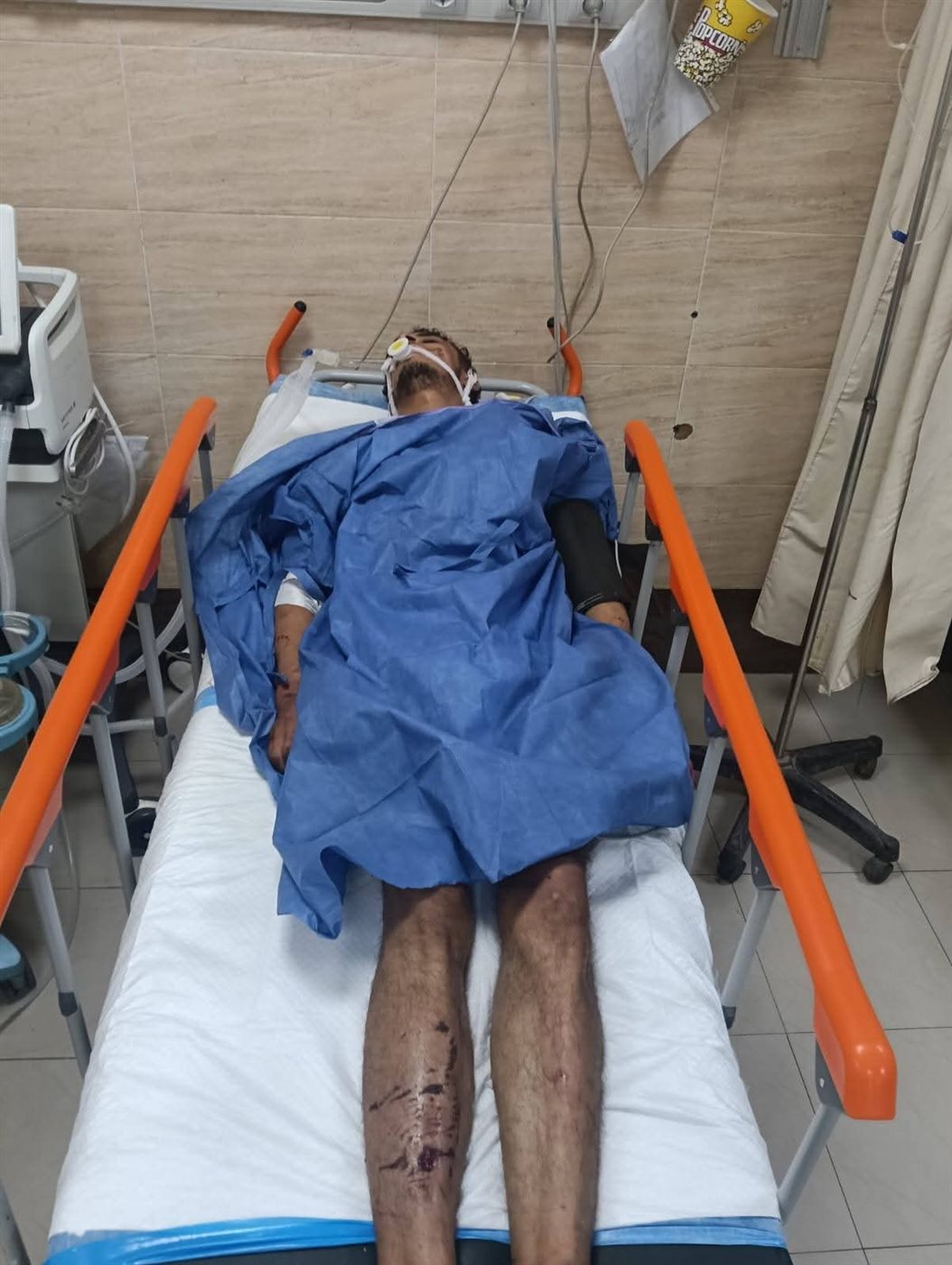 آثار التعذيب على الضحية