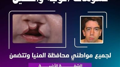  تقديم الخدمات الطبية لعدد 49 ألف و927 حالة بعيادات الأسنان