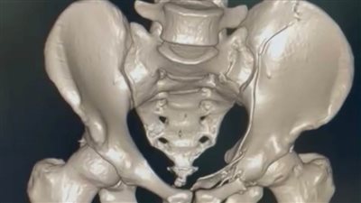 إجراء 4 عمليات جراحية طارئة لمريض محول من جنوب سيناء للشرقية