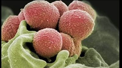 عاجل| الحمى القرمزية تقتل 6 أطفال ببريطانيا.. وتعرف على الأعراض