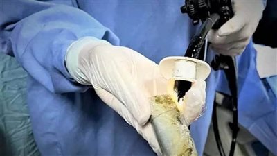 عاجل.. استخراج 