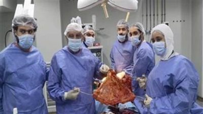 نجاح عملية استئصال ورم سرطاني بالقولون لسيدة بمستشفى السويس العام