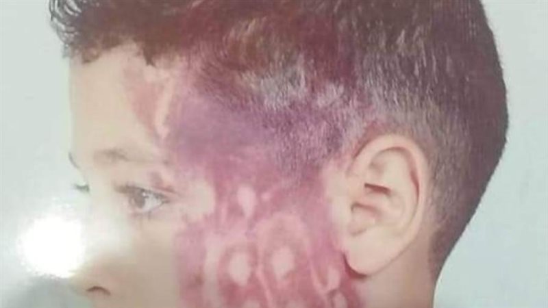 التلميذ المعتدى عليه