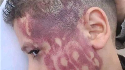 إخلاء سبيل المدرس المتهم بضرب تلميذ بالدقهلية بكفالة 5 آلاف جنيه 