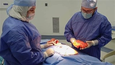 إنقاذ حياة مريضة بجراحة عاجلة لاستئصال ورم حميد بقها التخصصى