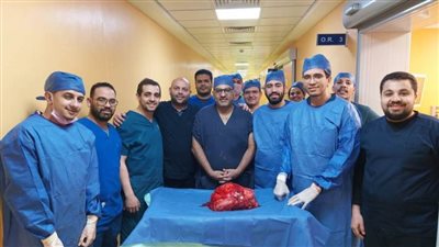 جامعة أسيوط تعلن عن نجاح فريق طبي في استئصال ورم خبيث يزن 20 كجم بالكلى