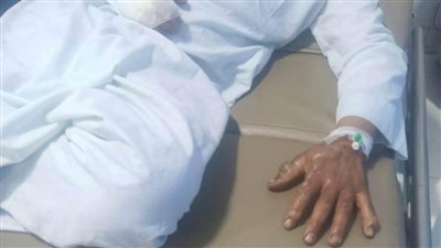 حبس متهمين أشعلا النيران في شاب بالشرقية 4 أيام 