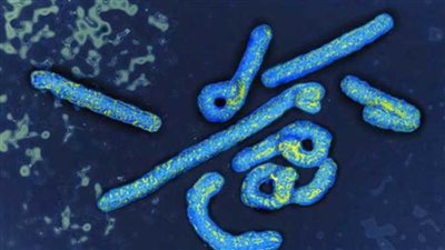 بعد بيان الصحة.. 20 معلومة عن فيروس ماربورج القاتل 