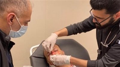 إصابة عضو بثوري 