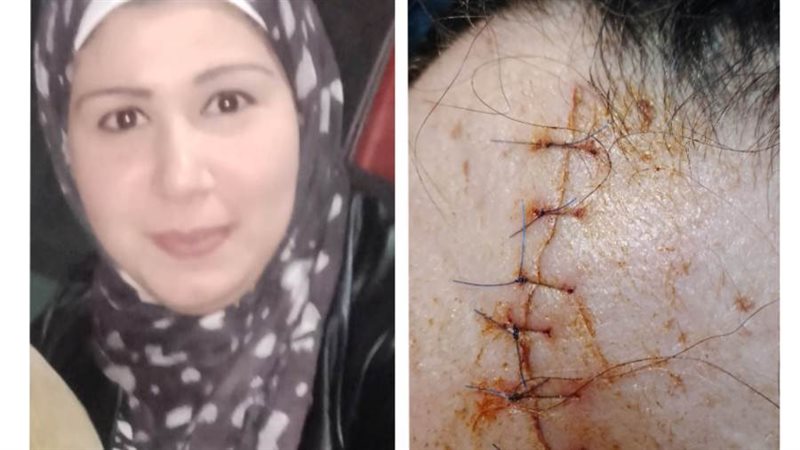 المجني عليها