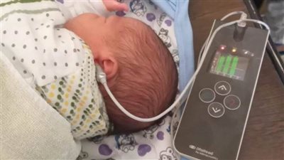 تقديم الخدمات الطبية والعلاجية لـ11 ألف طفل خلال مارس الماضي بالمنيا