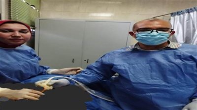 استخدام الأشعة التداخلية لسحب عينة من ورم بالثدي بمستشفى كفر الدوار