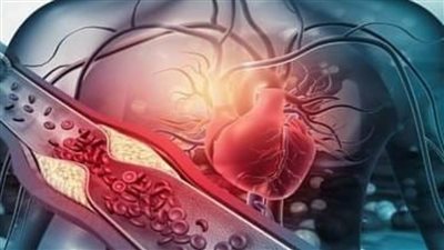 أهم نصائح الأطباء السعوديين للراغبين في أداء فريضة الحج