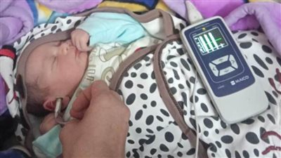 الصحة: فحص 4.581 مليون طفل بمبادرة الكشف المبكر وعلاج ضعف وفقدان السمع