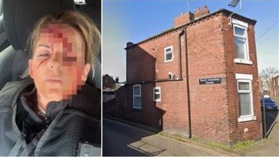 عاجل.. دماء على وجه الشقراء في مواجهة 