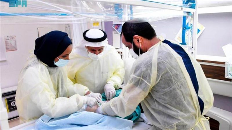 فصل التوأم السيامي