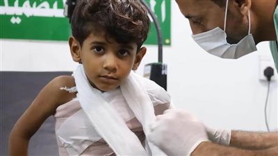 مركز الملك سلمان للإغاثة يدعم مركزًا للأطراف الصناعية ويقدم خدمات طبية في اليمن