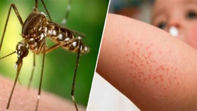 تسجيل 4 حالات إصابة بعدوى فيروس غرب النيل العام الحالي