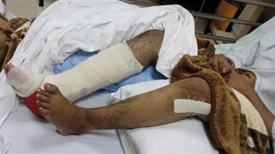 إصابة طالب سقط من الطابق الثالث بالقناطر الخيرية