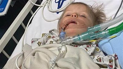 طفلة ليبية تبتلع بطارية ساعة