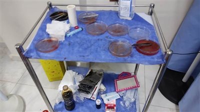  مركز طبى لزراعة الشعر تديره طالبة وحاصل على دبلوم بالدقهلية 