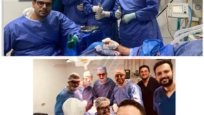 جراحة التجميل بمستشفيـات جامعة المنوفية ينجح في إعادة يد مبتورة للحركة (صور)