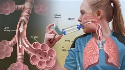 كل ما تريد معرفته عن الربو الشعبى للأطفال والكبار فى سطور