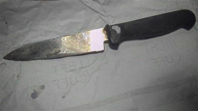 ابتلعه بالخطأ.. فريق طبي بمستشفى المنصورة الدولي يستخرج سكينًا من قولون مريض