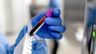 تطوير اختبار دم في منتصف العمر يمكنه الكشف عن خطر الخرف المبكر لدى السيدات