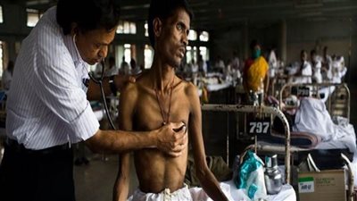 الصحة العالمية: 7 آلاف حالة وفاة في أوروبا بسبب السل كان يمكن تجنبها