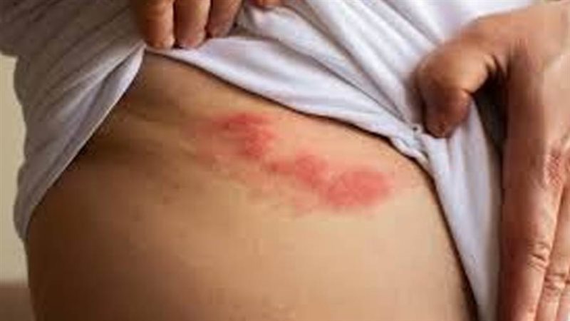 الحزام الناري