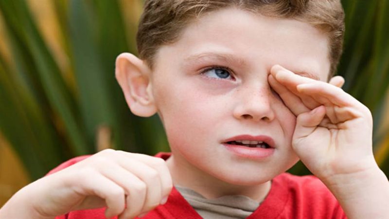تعرض طفلك للرمد الربيعي
