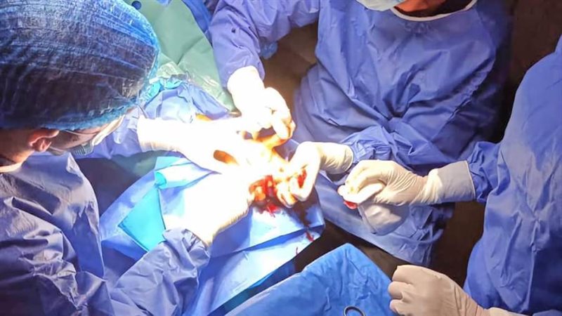 إجراء عملية دقيقة