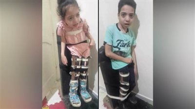 عاجل.. ”تقي ومحمد“ يعانيان من صرع مستعصي.. والأسرة تناشد ”الوزراء“ لعلاج الشقيقين