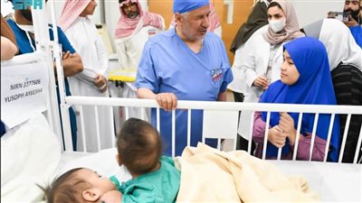 بدء عملية فصل التوأم السيامي الفلبيني 