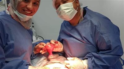 نجاح إجراء عمليتي أورام سرطانية لسيدتين بمستشفى الخارجة