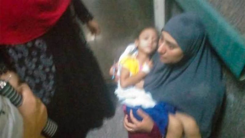طفلة مصابة بمستشفى