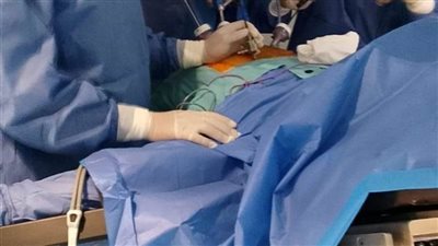 وحدة جراحة السمنة والمناظير المتقدمة بمستشفى إدكو تواصل تقديم خدماتها لأهالي البحيرة