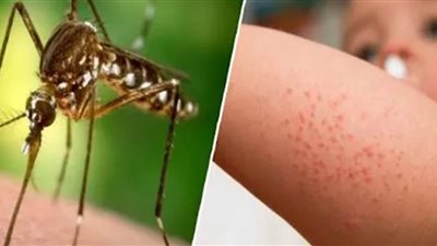 الأردن يعلن تسجيل أول إصابة بحمى النيل الغربي لطفلة ٦ سنوات