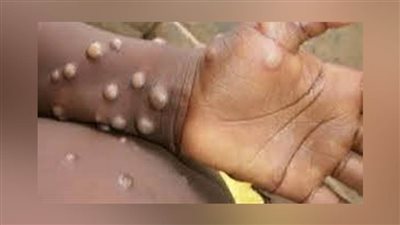 الصحة تطمئن المصريين من 