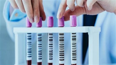 اختبار دم بالذكاء الاصطناعي يتنبّأ بمخاطر 18 مرضاً للشيخوخة