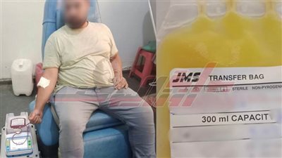 بدء التشغيل التجريبي لخدمة فصل الصفائح الدموية ببنك دم مستشفى دسوق العام