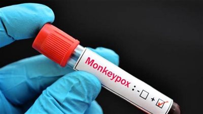 روسيا: الاختبارات ما قبل السريرية للقاح جدري القردة ستستغرق 3-5 أشهر