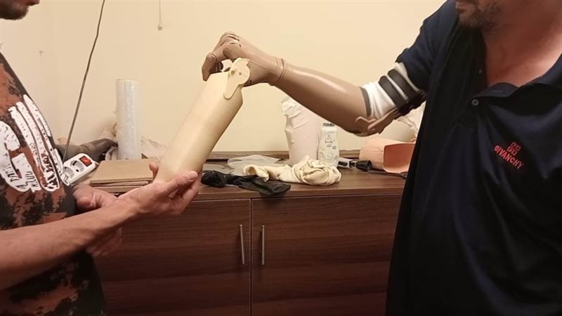 تسليم الأطراف