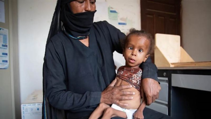 سوء التغذية في منطقة