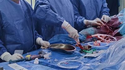 بعد توقف عضلة القلب.. إجراء 3 عمليات قسطرة قلبية بمستشفى الزقازيق العام 