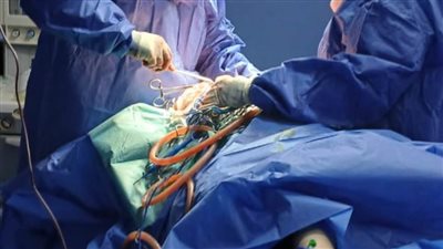 الفريق الطبي بمستشفى بلبيس المركزي ينجح في إنقاذ حياة طفلة سقطت من علو