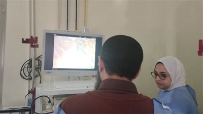 فريق طبي بمستشفى الراجحي بجامعة أسيوط ينجح في تفتيت حصوات كبيرة بالقنوات المرارية