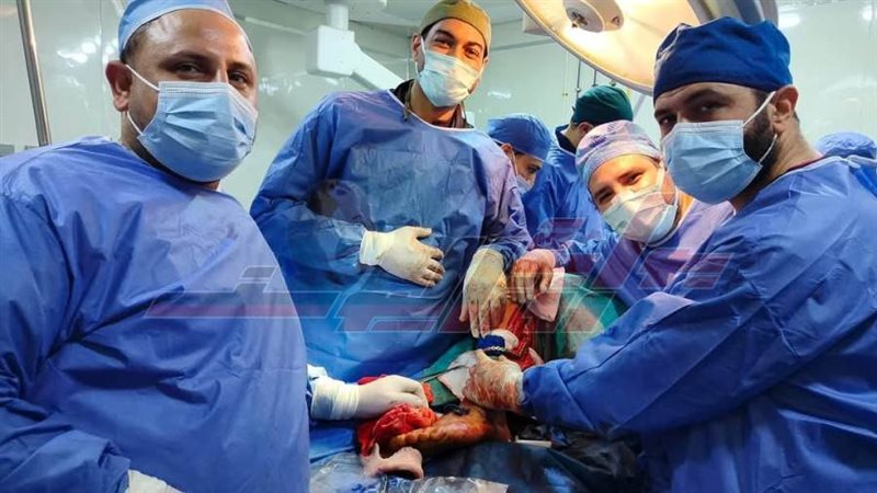 العملية الجراحية